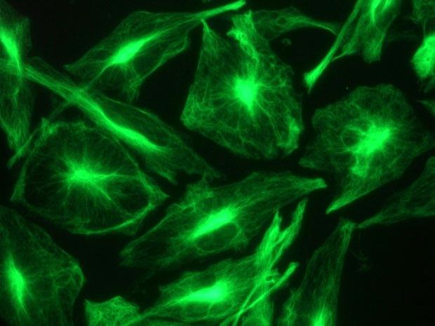 Figure 2._MUB1302 Figure 2 Immunostaining of intracellular nestin filaments in U251 cells